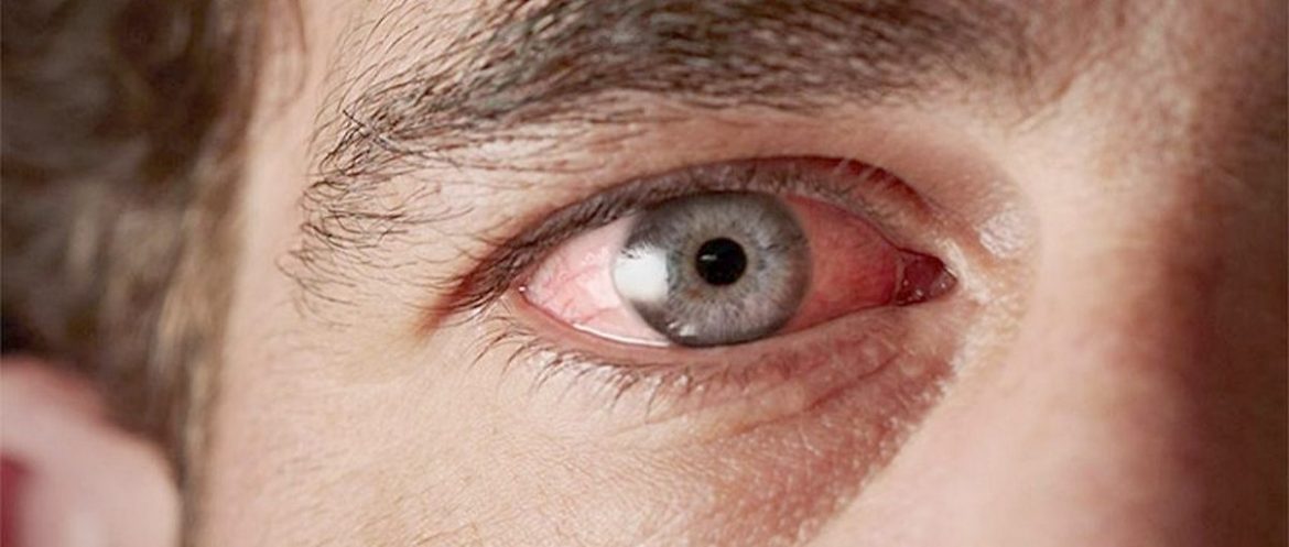 Как Covid-19 может ударить по зрению