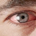 Как Covid-19 может ударить по зрению