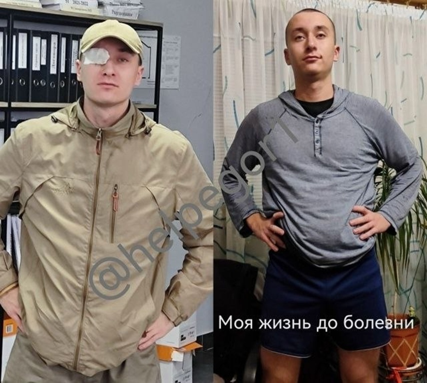 Егор Супрунюк